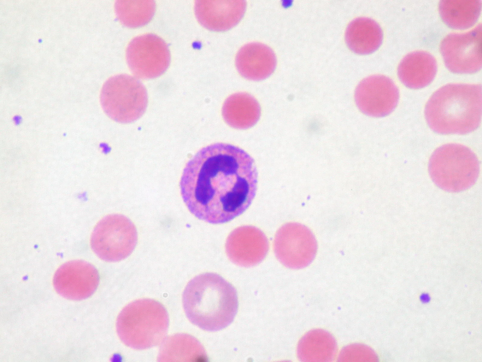 Glóbulos rojos en un frotis de sangre