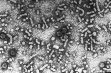 Partículas del virus de la hepatitis B vistas al microscopio electrónico