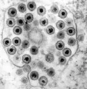 Virus herpes simple